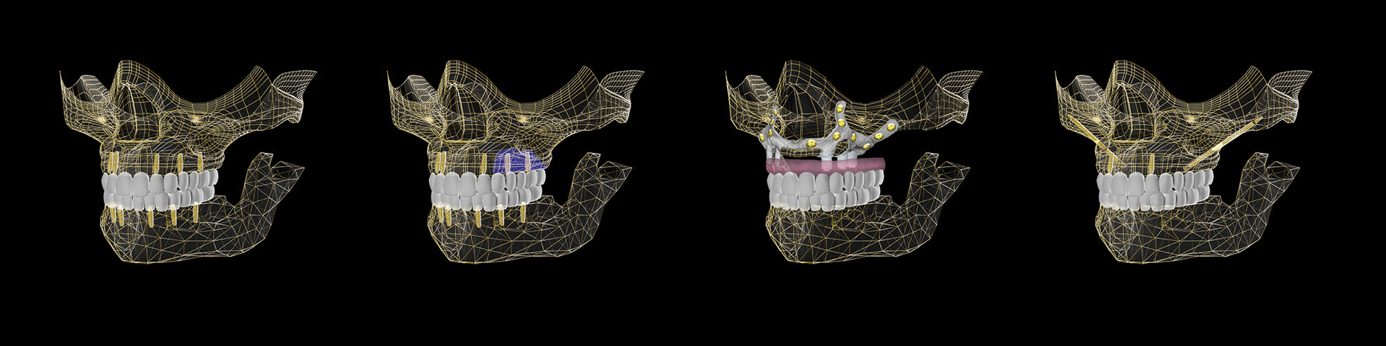 calavera teethwow tratamientos Teethwow treatments