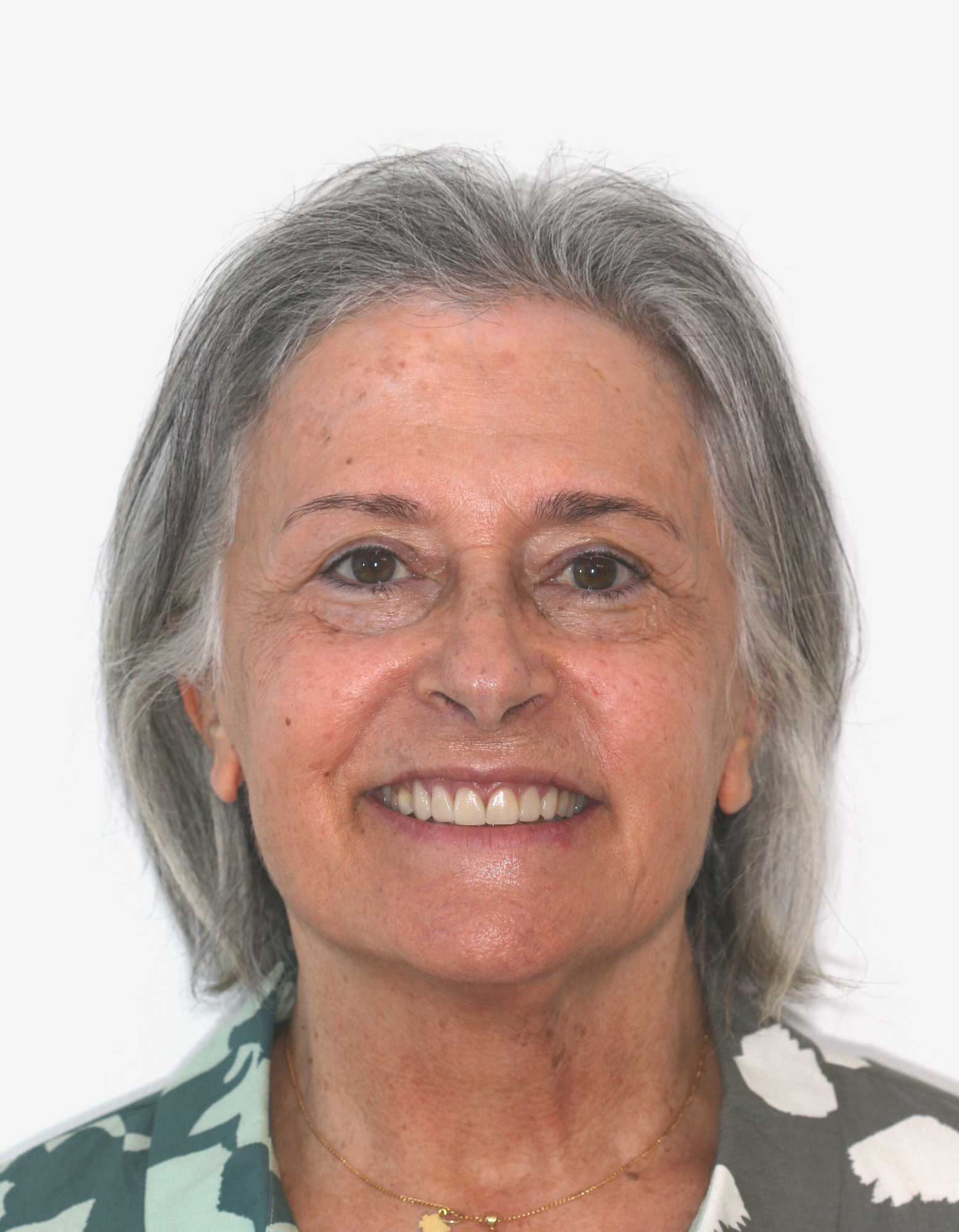 patient testimonial painless anaesthesia patient testimonial painless anaesthesia