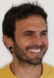 Aesthetic Case In Young Patient