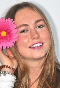 Composite Veneers - Young Girl