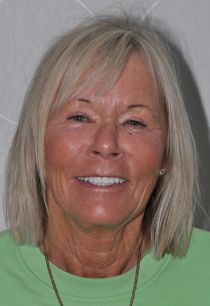 Crowns and Veneers for the elderly, Full Mouth aesthetics