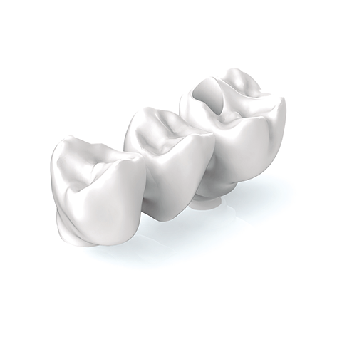 materiales puente zirconio