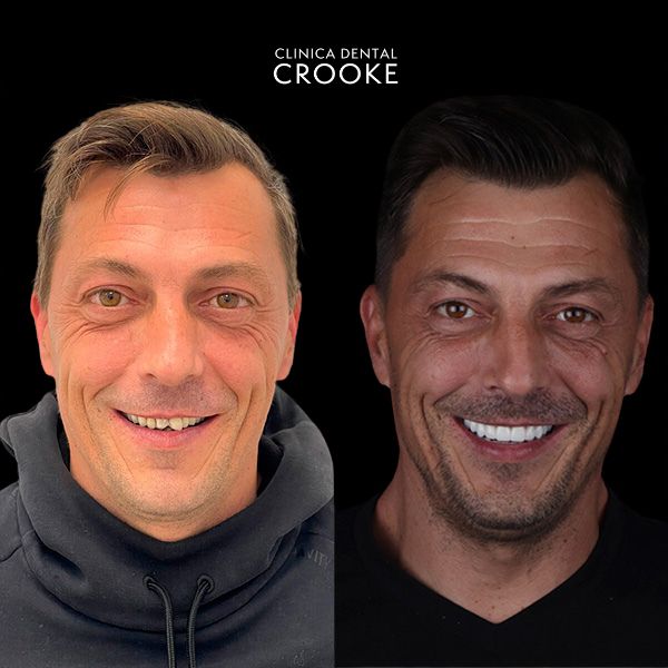 REHABILITACIONES COMPLETAS