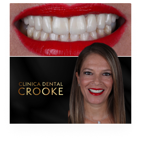 Prensa Crokke 8